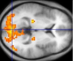 A fMRI scan showing regions of activation in o...