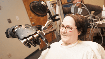 Woman with Quadriplegia Feeds Herself Chocolate Using Mind-Controlled Robot Arm
