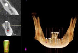 Biological tooth replacement -- a step closer