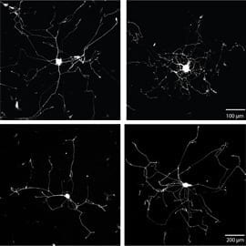 Making Axons Branch and Grow to Help Nerve Regeneration After Injury