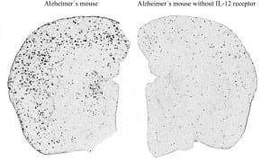 Alzheimer’s Disease in Mice Alleviated Promising Therapeutic Approach for Humans