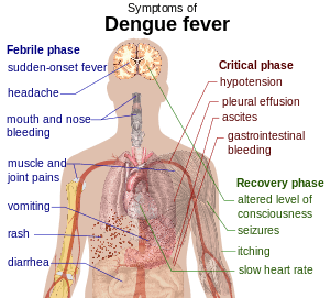 As Dengue Fever Sweeps India, a Slow Response Stirs Experts’ Fears