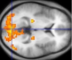 The Brain Activity Map
