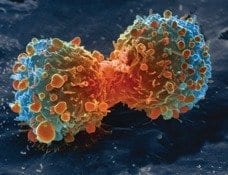 New Cancer Diagnostic Technique Debuts