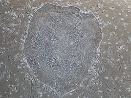 No More Need for Embryonic Stem Cells