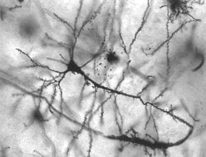 Epilepsy Cured in Mice Using Brain Cells