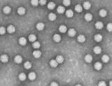 New Gene Therapy Shows Broad Protection in Animal Models to Pandemic Flu Strains, including the Deadly 1918 Spanish Influenza