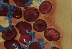 Laser-Controlled Molecular Switch Turns Blood Clotting On, Off On Command