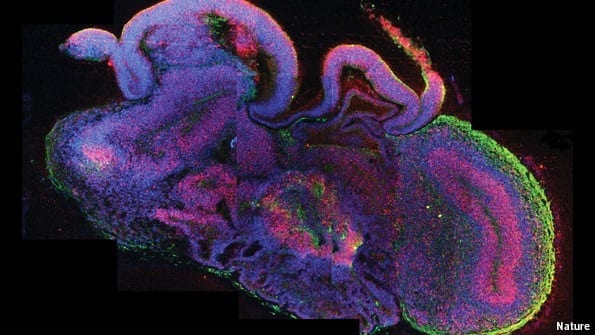 Growing model brains: An embryonic idea