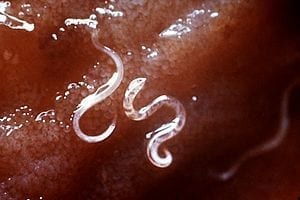 Natural pest control protein effective against hookworm: A billion could benefit