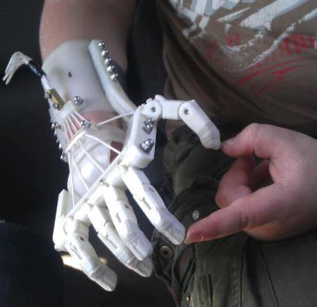 Robohand Uses 3-D Printing to Replace Lost Digits
