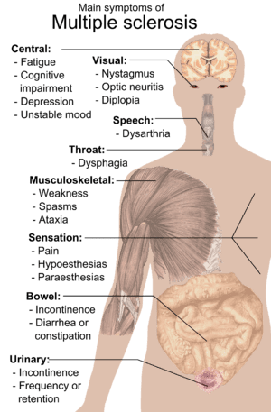 300px-Symptoms_of_multiple_sclerosis
