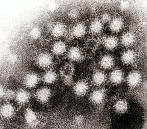 New study discovers copper destroys highly infectious norovirus