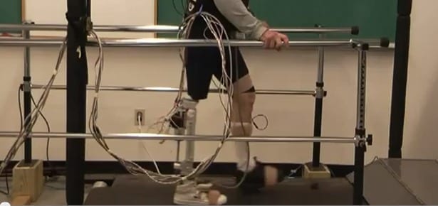 Researchers Seek to Control Prosthetic Legs with Neural Signals