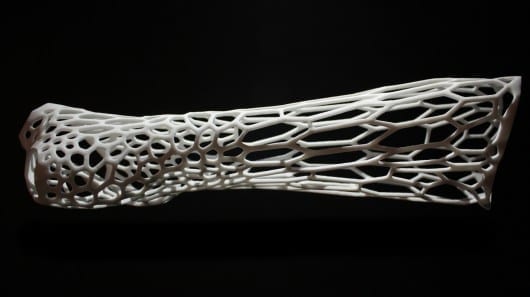 3D-printed Cortex concept scratches the itch of healing broken bones