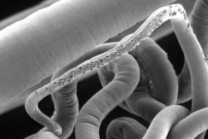 Important step-forward in mission to tackle parasitic worm infections