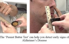 VIDEO: UF researchers find that ‘peanut butter’ test can help diagnose Alzheimer’s disease
