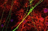 New Strategy to Treat Multiple Sclerosis Shows Promise in Mice