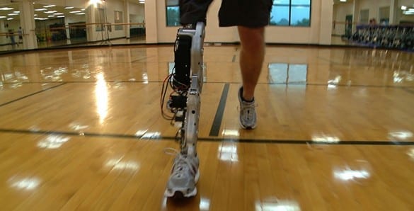 Robotic advances promise artificial legs that emulate healthy limbs