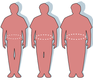 New research shows obesity is an inflammatory disease