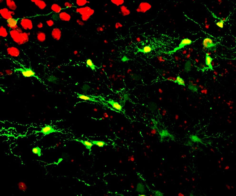 Neuron regeneration may help sufferers of brain injury, Alzheimer's disease