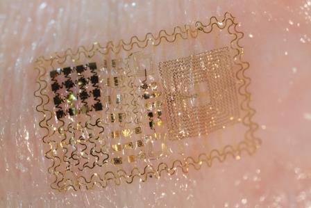 Ultrathin “Diagnostic Skin” Allows Continuous Patient Monitoring