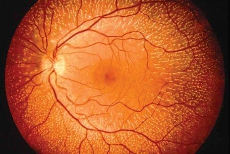 Cells from the eye are inkjet printed for the first time
