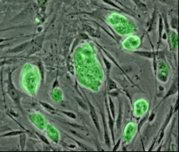 Lab-Grown, Virus-Free Stem Cells Repair Retinal Tissue in Mice