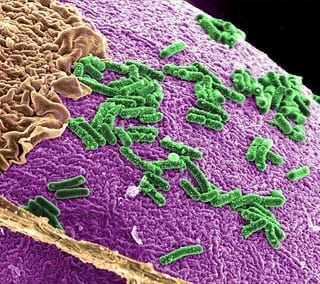 Altering Community of Gut Bacteria Promotes Health and Increases Lifespan