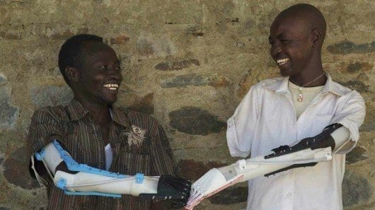 3D-printed prostheses give hope to amputees in war-torn Sudan