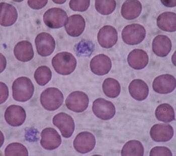 New stem cell method may eliminate need for blood donations to maintain platelet supply