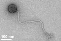 New anthrax-killing virus from Africa is unusually large