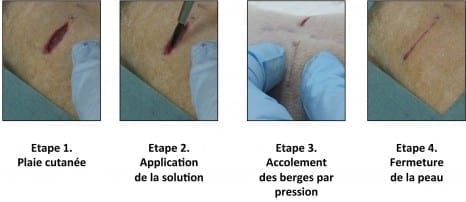 Phase 1 Skin injury Phase 2 Application of the solution Phase 3 Using pressure to hold the edges together Phase 4 Skin closure Illustration of the first experiment conducted by the resear chers on rats: a deep wound is repaired by applying the aqueous nanoparticle solution. The wound closes in thirty seconds. © “Matière Molle et Chimie” Laboratory (CNRS/ESPCI Paris Tech)