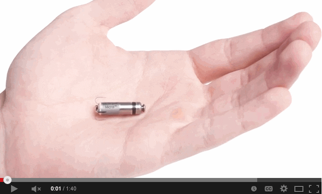 World's Smallest, Leadless Heart Pacemaker Implanted
