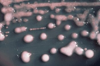 Klebsiella pneumoniae, the bacterium in which NDM-1 was first identified. (Photo credit: Wikipedia)