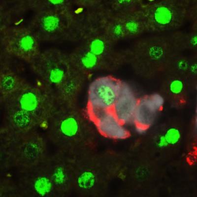 When the Hippo pathway is inactivated, mature liver cells revert back to a stem cell-like state. Picture shows a group of cells transitioning from a mature cell type (green) to a stem cell type (red). White cells are the cells where Hippo is being inactivated. Credit: Dean Yimlamai/Boston Children's Hospital