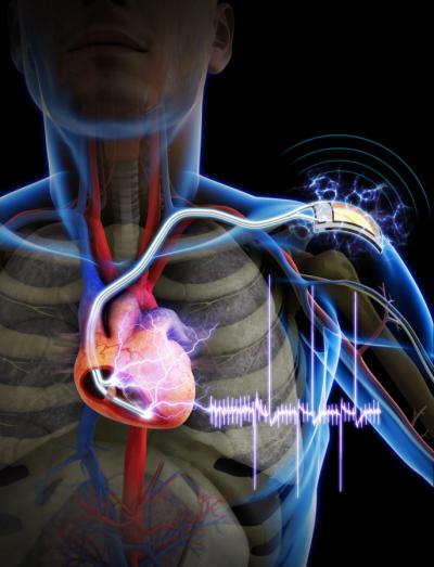 The first demonstration of a self-powered cardiac pacemaker