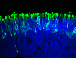 Researchers Use Human Stem Cells to Create Light-Sensitive Retina in a Dish