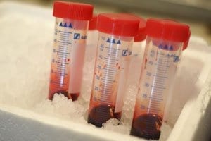 The quest for long-lasting blood