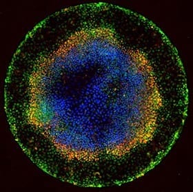 Using geometry, researchers coax human embryonic stem cells to organize themselves