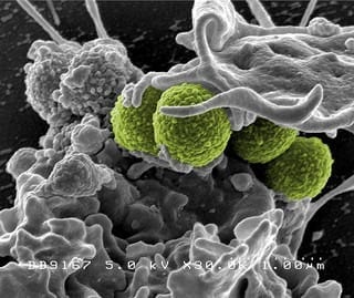 Hospital-Associated Methicillin-resistant Staphylococcus aureus (MRSA) Bacteria (Photo credit: NIAID)
