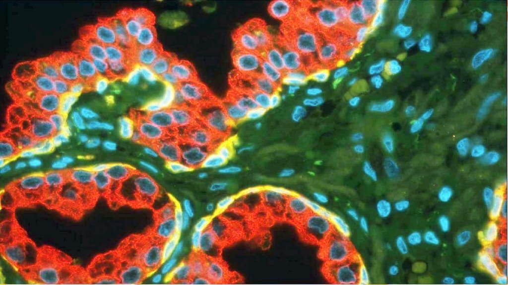 The tissue section through a prostate reveals whether cancer cells are present. (Photo: Lukas Kenner)