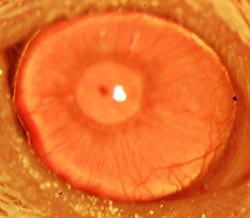 Researchers Regrow Human Corneas: First Known Tissue Grown from a Human Stem Cell