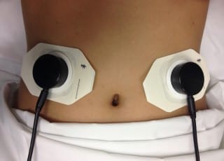 UCLA The non-invasive acoustic gastrointestinal surveillance biosensor.
