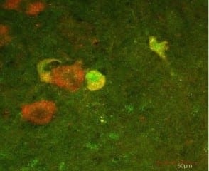 Salk Institute for Biological Studies The presence of p45 (green staining) and p75 (red staining) indicates that motor neurons increase both p45 and p75 expression after sciatic nerve injury in an animal.