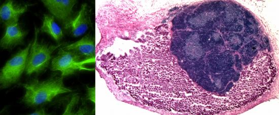 Fibroblasts transformed into induced thymic epithelial cells (iTEC) in vitro (left, iTEC in green). iTEC transplanted onto the mouse kidney form an organised and functional mini-thymus (right, kidney cells in pink, thymus cells in dark blue)