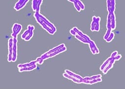 DNA damage resulting in multiple broken chromosomes (Photo credit: Wikipedia)