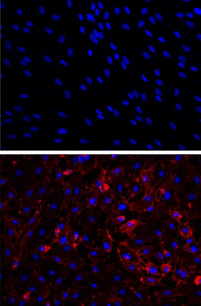 Scar cells (top, nuclei stained blue) are coaxed into becoming blood vessel cells with a new, small-molecule and protein therapy. Evidence of the conversion is shown in the second panel (bottom), where red staining indicates the presence of CD31, a protein made by blood vessel cells. In a new Circulation paper, Houston Methodist scientists report these transformed cells self-assembled into vessels that improved blood flow. Credit: Jack Wong, Houston Methodist Research Institute 