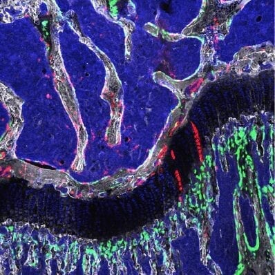 Bone stem cells shown to regenerate bone and cartilage in adult mice