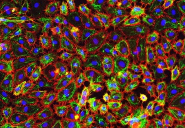 New test uses human stem cells to identify dangerous side effects of drugs